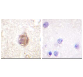 Immunohistochemistry - Anti-IRS-1 (phospho Ser794) Antibody (A0668) - Antibodies.com