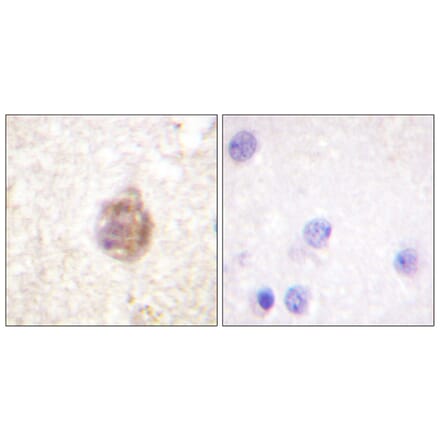 Immunohistochemistry - Anti-IRS-1 (phospho Ser794) Antibody (A0668) - Antibodies.com