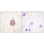 Immunohistochemistry - Anti-IRS-1 (phospho Ser794) Antibody (A0668) - Antibodies.com