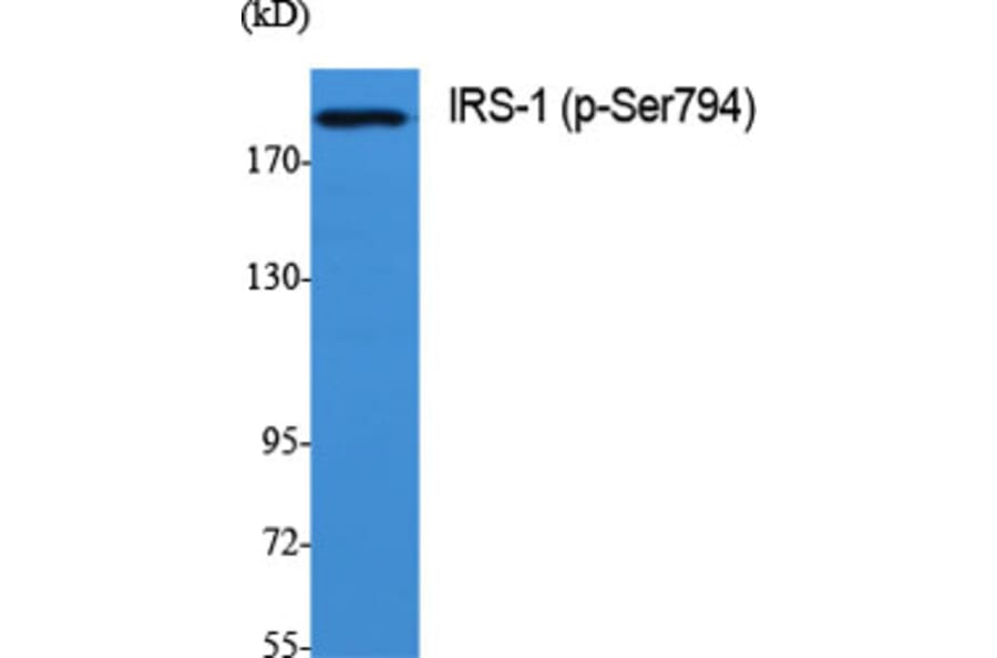 Western Blot - Anti-IRS-1 (phospho Ser794) Antibody (A0668) - Antibodies.com