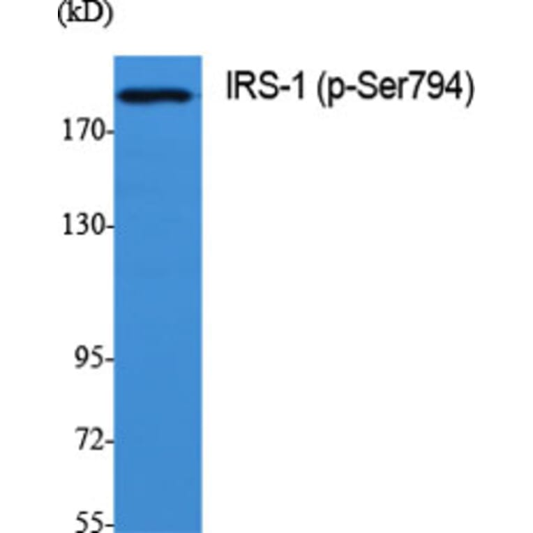 Western Blot - Anti-IRS-1 (phospho Ser794) Antibody (A0668) - Antibodies.com
