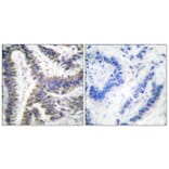 Immunohistochemistry - Anti-DFF45 (cleaved Asp224) Antibody (L0113) - Antibodies.com