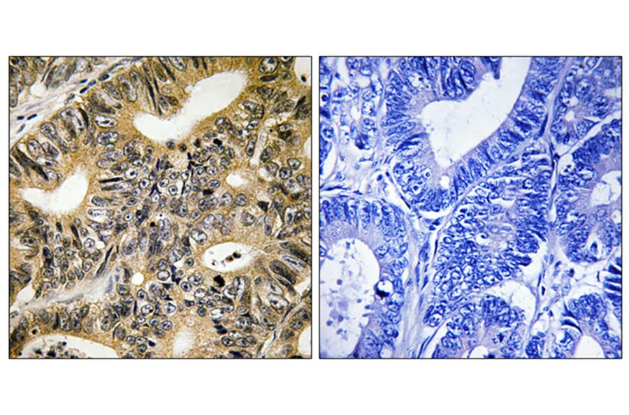 Immunohistochemistry - Anti-4E-BP1 (phospho Thr70) Antibody (A8283) - Antibodies.com