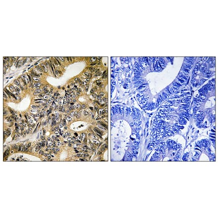 Immunohistochemistry - Anti-4E-BP1 (phospho Thr70) Antibody (A8283) - Antibodies.com