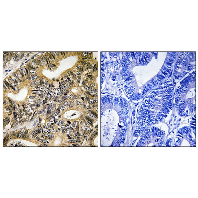 Immunohistochemistry - Anti-4E-BP1 (phospho Thr70) Antibody (A8283) - Antibodies.com