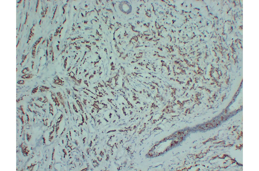 Immunohistochemistry - Anti-Progesterone Receptor Antibody (V0114) - Antibodies.com