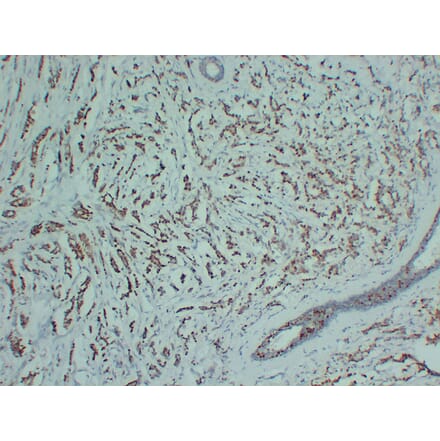 Immunohistochemistry - Anti-Progesterone Receptor Antibody (V0114) - Antibodies.com