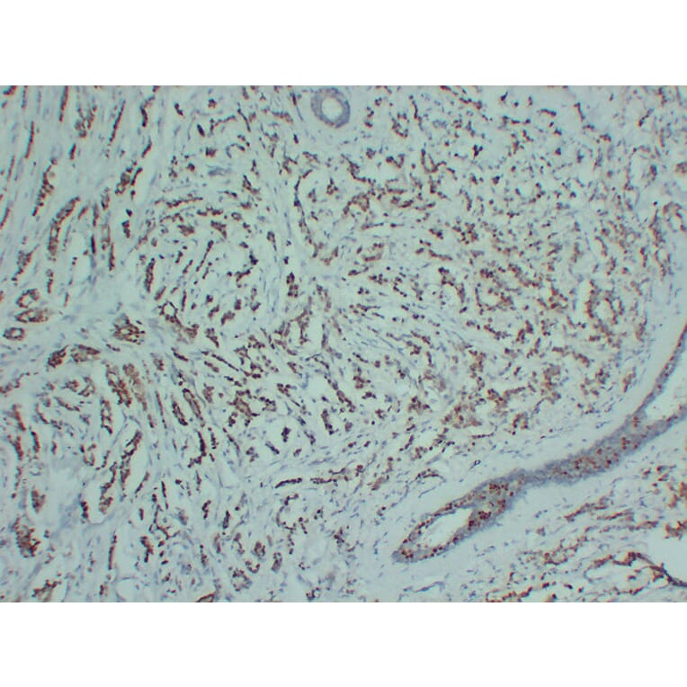 Immunohistochemistry - Anti-Progesterone Receptor Antibody (V0114) - Antibodies.com