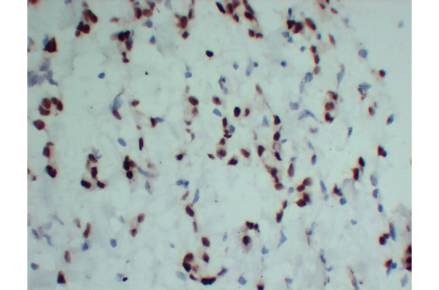 Immunohistochemistry - Anti-Progesterone Receptor Antibody (V0114) - Antibodies.com