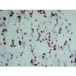 Immunohistochemistry - Anti-Progesterone Receptor Antibody (V0114) - Antibodies.com