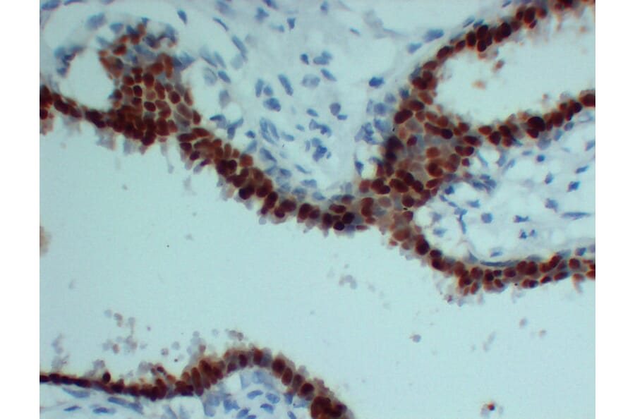 Immunohistochemistry - Anti-Progesterone Receptor Antibody (V0114) - Antibodies.com