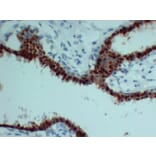 Immunohistochemistry - Anti-Progesterone Receptor Antibody (V0114) - Antibodies.com