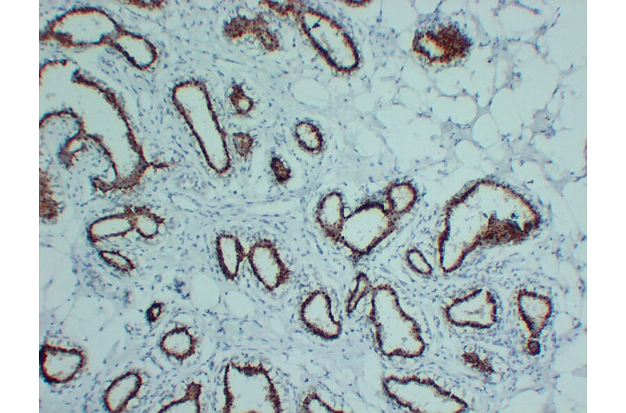 Immunohistochemistry - Anti-Progesterone Receptor Antibody (V0114) - Antibodies.com