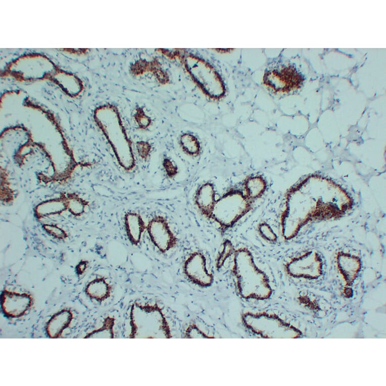 Immunohistochemistry - Anti-Progesterone Receptor Antibody (V0114) - Antibodies.com