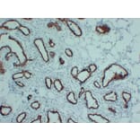 Immunohistochemistry - Anti-Progesterone Receptor Antibody (V0114) - Antibodies.com