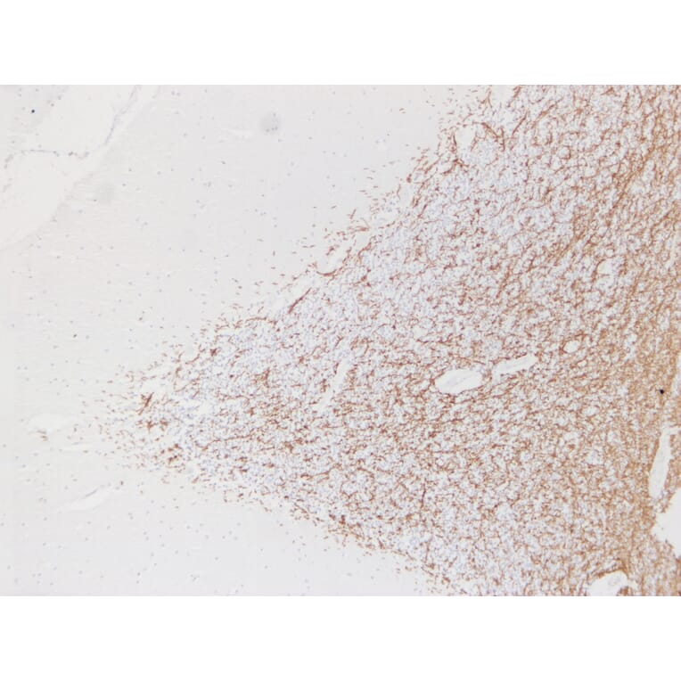 Immunohistochemistry - Anti-Myelin Basic Protein Antibody (V0099) - Antibodies.com