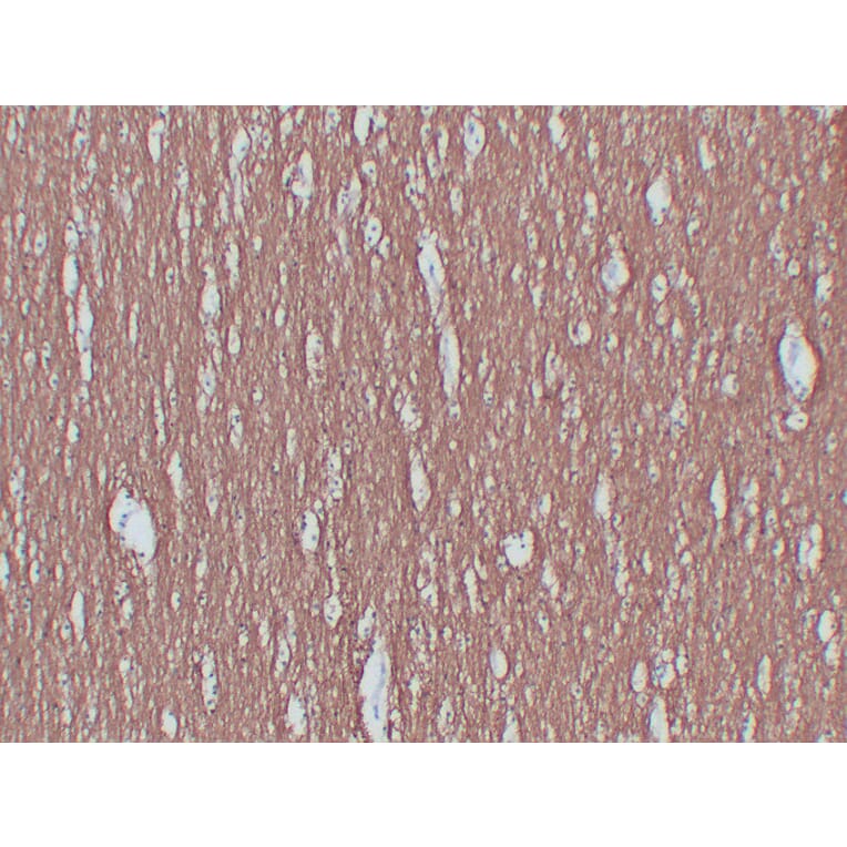 Immunohistochemistry - Anti-Myelin Basic Protein Antibody (V0099) - Antibodies.com