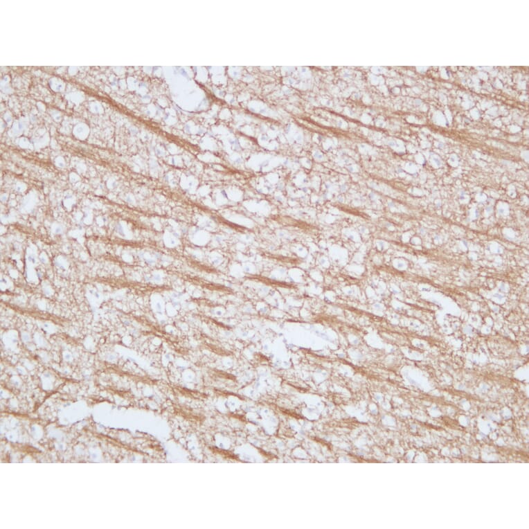 Immunohistochemistry - Anti-Myelin Basic Protein Antibody (V0099) - Antibodies.com