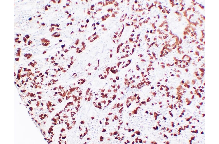 Immunohistochemistry - Anti-Adrenocorticotropin Antibody (V0001) - Antibodies.com