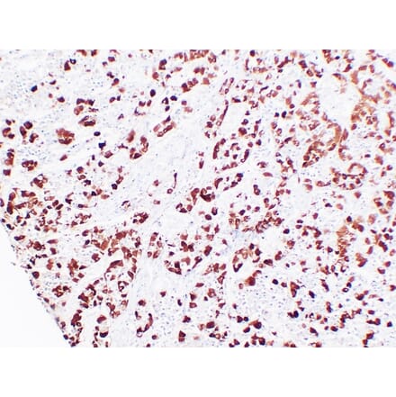 Immunohistochemistry - Anti-Adrenocorticotropin Antibody (V0001) - Antibodies.com