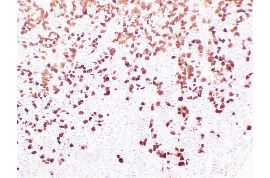 Immunohistochemistry - Anti-Adrenocorticotropin Antibody (V0001) - Antibodies.com