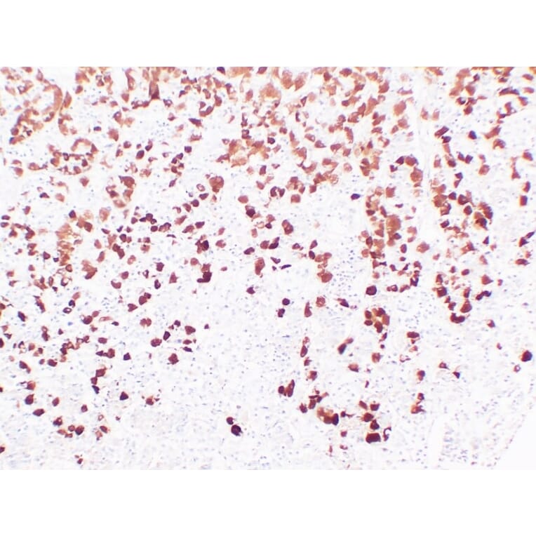Immunohistochemistry - Anti-Adrenocorticotropin Antibody (V0001) - Antibodies.com