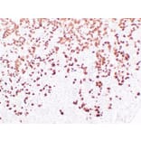 Immunohistochemistry - Anti-Adrenocorticotropin Antibody (V0001) - Antibodies.com