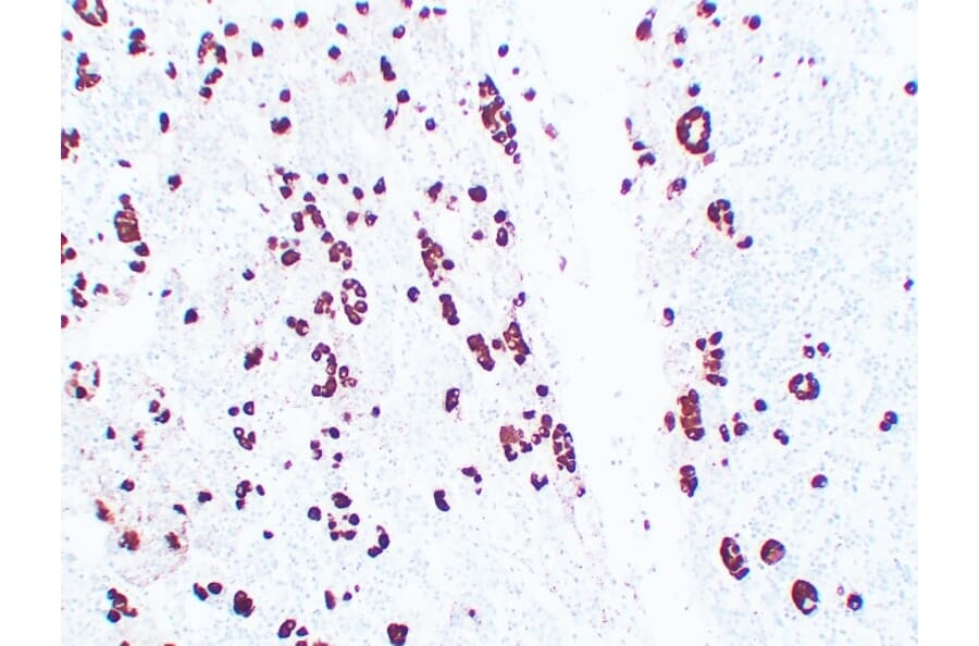 Immunohistochemistry - Anti-Adrenocorticotropin Antibody (V0001) - Antibodies.com