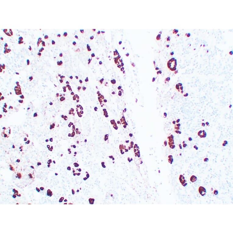 Immunohistochemistry - Anti-Adrenocorticotropin Antibody (V0001) - Antibodies.com