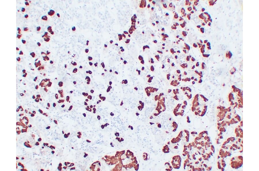 Immunohistochemistry - Anti-Adrenocorticotropin Antibody (V0001) - Antibodies.com