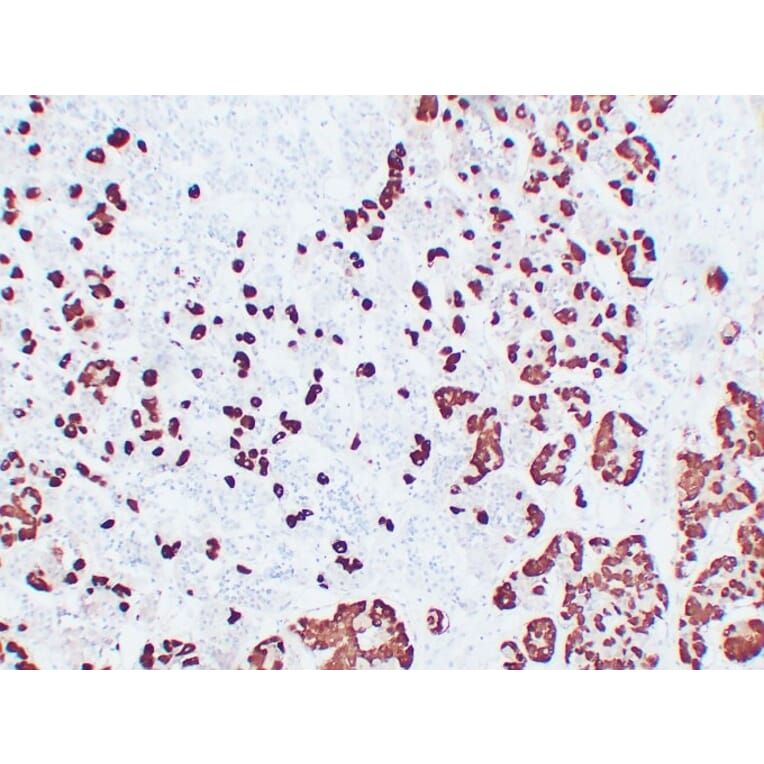 Immunohistochemistry - Anti-Adrenocorticotropin Antibody (V0001) - Antibodies.com