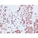 Immunohistochemistry - Anti-Adrenocorticotropin Antibody (V0001) - Antibodies.com