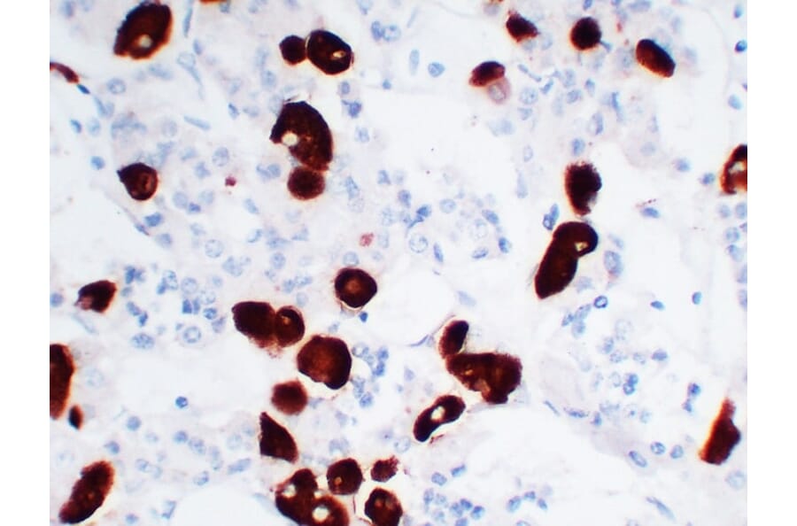 Immunohistochemistry - Anti-Adrenocorticotropin Antibody (V0001) - Antibodies.com