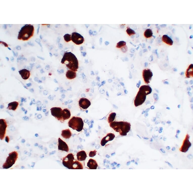 Immunohistochemistry - Anti-Adrenocorticotropin Antibody (V0001) - Antibodies.com