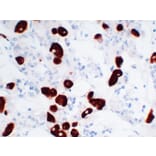 Immunohistochemistry - Anti-Adrenocorticotropin Antibody (V0001) - Antibodies.com