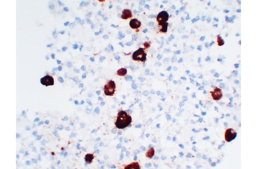 Immunohistochemistry - Anti-Adrenocorticotropin Antibody (V0001) - Antibodies.com