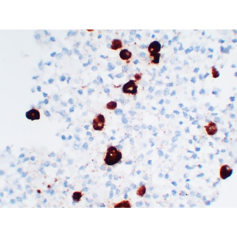 Immunohistochemistry - Anti-Adrenocorticotropin Antibody (V0001) - Antibodies.com