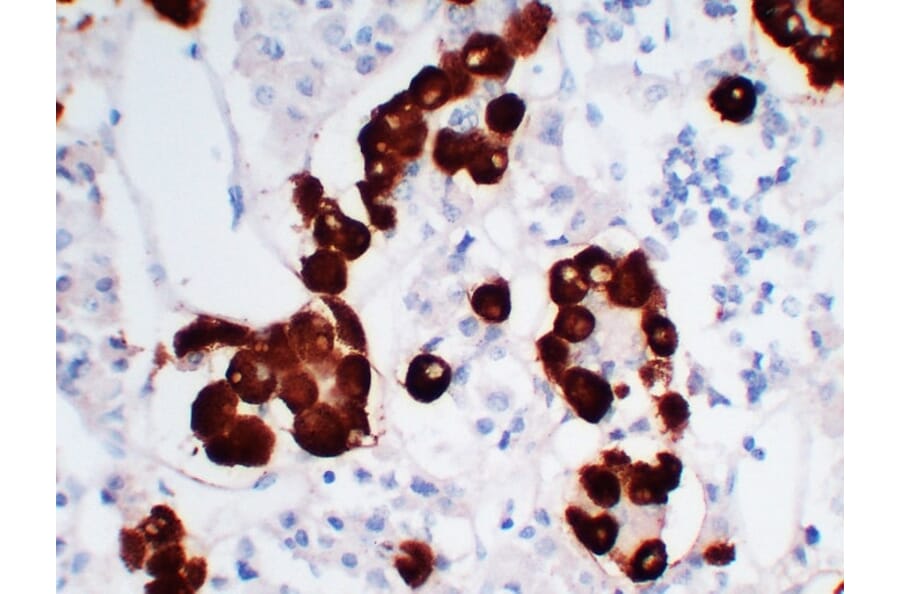 Immunohistochemistry - Anti-Adrenocorticotropin Antibody (V0001) - Antibodies.com