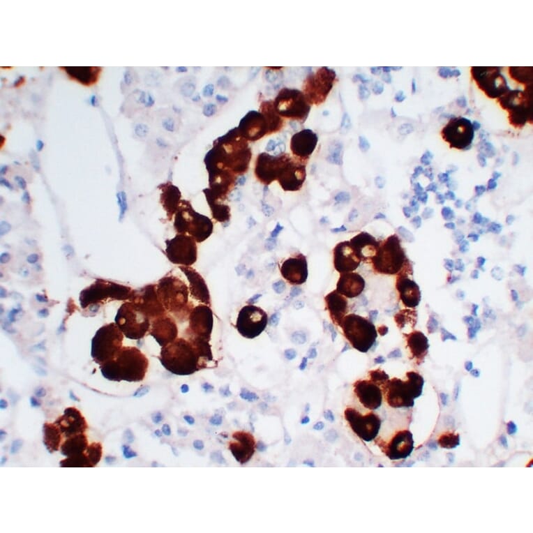 Immunohistochemistry - Anti-Adrenocorticotropin Antibody (V0001) - Antibodies.com