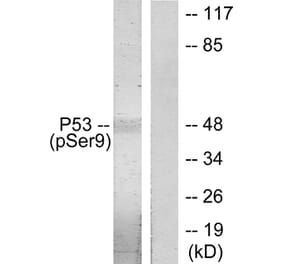 Western Blot - Anti-p53 (phospho Ser9) Antibody (A7186) - Antibodies.com