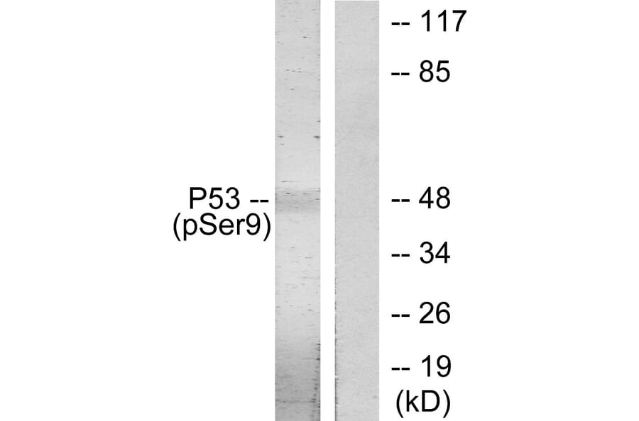 Western Blot - Anti-p53 (phospho Ser9) Antibody (A7186) - Antibodies.com