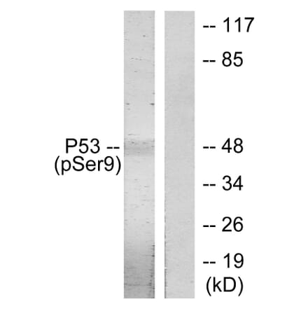 Western Blot - Anti-p53 (phospho Ser9) Antibody (A7186) - Antibodies.com
