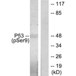 Western Blot - Anti-p53 (phospho Ser9) Antibody (A7186) - Antibodies.com