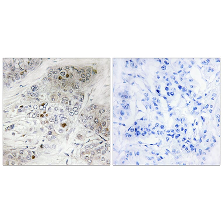 Immunohistochemistry - Anti-p53 (phospho Ser9) Antibody (A7186) - Antibodies.com