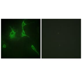 Immunofluorescence - Anti-Collagen IX alpha3 Antibody (C12212) - Antibodies.com