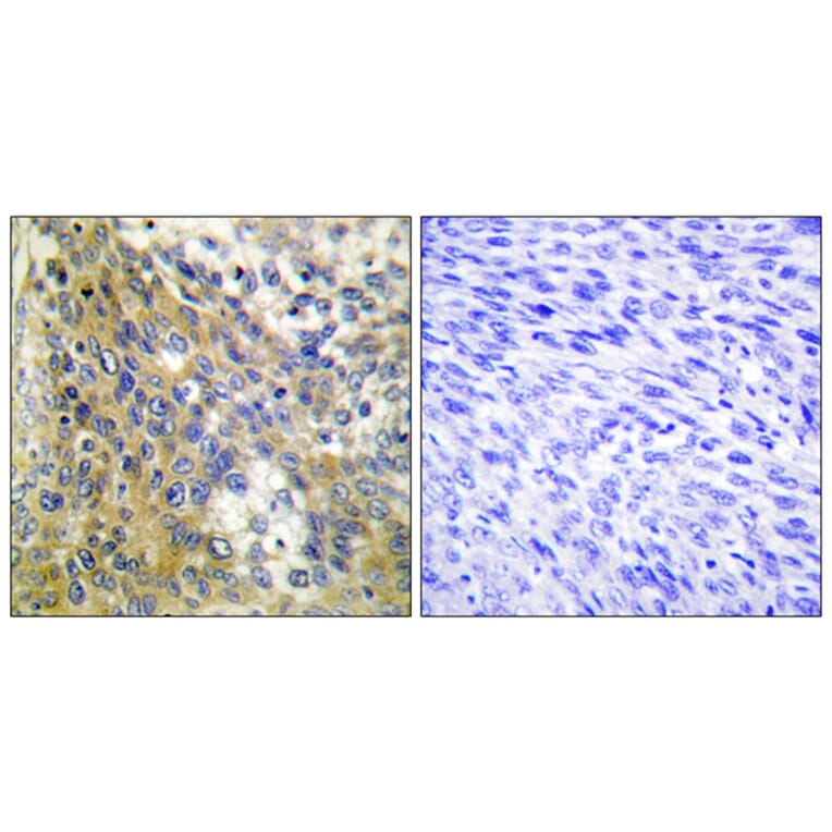 Immunohistochemistry - Anti-Collagen IV alpha6 Antibody (C12200) - Antibodies.com