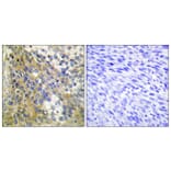 Immunohistochemistry - Anti-Collagen IV alpha6 Antibody (C12200) - Antibodies.com