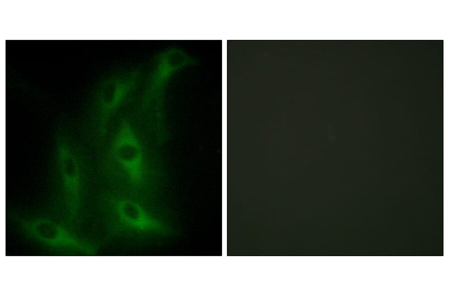 Immunofluorescence - Anti-Collagen IV alpha6 Antibody (C12200) - Antibodies.com