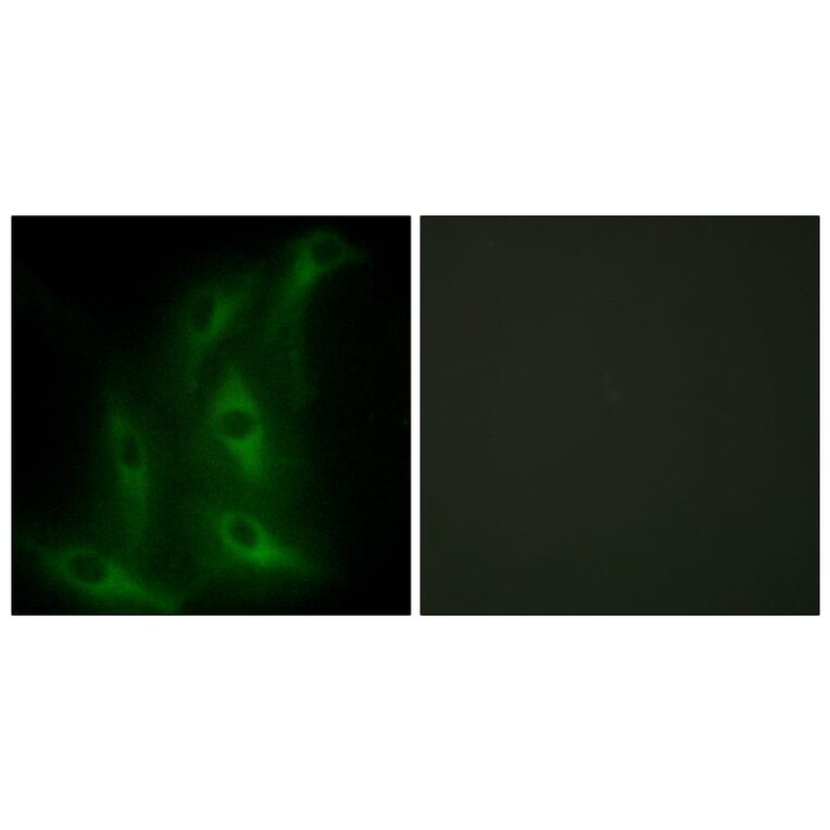 Immunofluorescence - Anti-Collagen IV alpha6 Antibody (C12200) - Antibodies.com