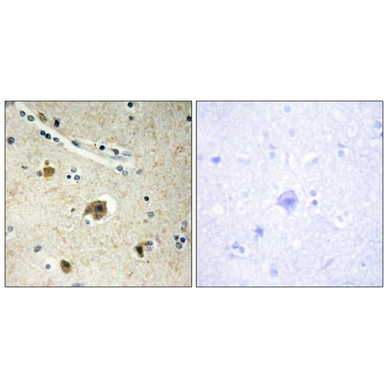 Immunohistochemistry - Anti-Collagen IV alpha4 Antibody (C12198) - Antibodies.com
